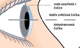 roztok na čočky Complete RevitaLens.