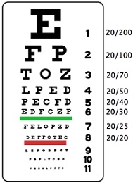 myopia 12 dioptria olyan homályos látás a cseppektől